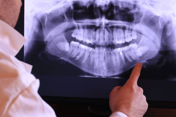 Best Emergency Dental Care for Broken or Chipped Teeth in Westby, WI