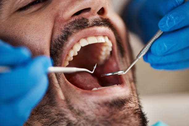 Best Emergency Dental Care for Broken or Chipped Teeth in Westby, WI